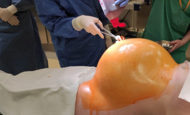 Fot. archiwum Wojewódzki Szpital Podkarpacki im. Jana Pawła II w Krośnie