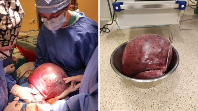 Fot. archiwum Wojewódzki Szpital Podkarpacki im. Jana Pawła II w Krośnie